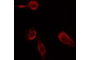 ABIN6275785 staining Hela cells by IF/ICC. (Phospholipase C beta 2 anticorps  (Internal Region))