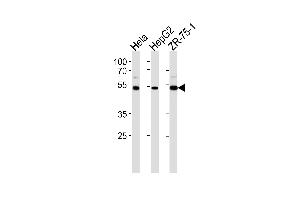TERF2IP Antibody (C-term) (ABIN657968 and ABIN2846914) western blot analysis in Hela,HepG2,ZR-75-1 cell line lysates (35 μg/lane). (RAP1 anticorps  (C-Term))