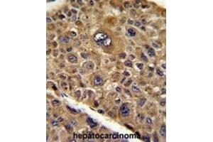 Immunohistochemistry (IHC) image for anti-Protein Tob1 (TOB1) antibody (ABIN3003808)