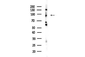 Western blot analysis of lysates from HepG2 cells(LPS,4h treatment), using Matriptase Antibody at 1/1000 dilution.