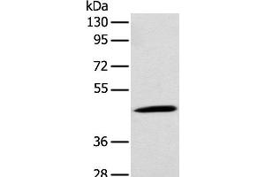 Western blot analysis of Rat kidney tissue using CCBL1 Polyclonal Antibody at dilution of 1:300 (CCBL1 anticorps)