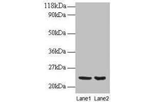 Western blot All lanes: PRDX1 antibody at 2 μg/mL Lane 1: EC109 whole cell lysate Lane 2: 293T whole cell lysate Secondary Goat polyclonal to rabbit IgG at 1/15000 dilution Predicted band size: 23 kDa Observed band size: 23 kDa (Peroxiredoxin 1 anticorps  (AA 1-199))