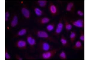 Image no. 1 for anti-Myocyte Enhancer Factor 2A (MEF2A) (pThr312) antibody (ABIN196682) (MEF2A anticorps  (pThr312))