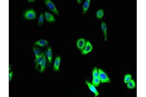 anti-Solute Carrier Family 46, Member 3 (SLC46A3) (AA 26-73) antibody