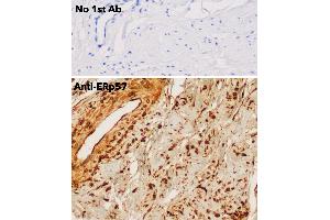 Immunohistochemistry (IHC) image for anti-Protein Disulfide Isomerase Family A, Member 3 (PDIA3) (C-Term) antibody (ABIN1440039)