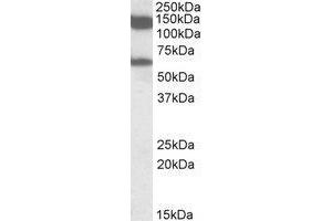 AP20116PU-N AF10 antibody staining of Rat Testis lysate at 1 µg/ml (RIPA buffer, 35 µg total protein per lane). (MLLT10 anticorps  (Internal Region))