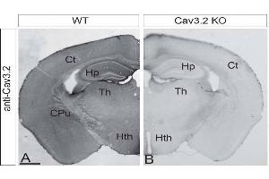 Immunohistochemistry of coronal brain sections from WT and Cav3.