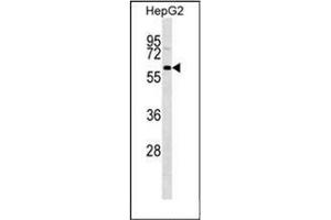 Western blot analysis of GFRA3 Antibody (Center) Cat.