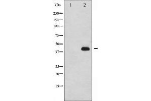 Western blot analysis of p47 phox phosphorylation expression in nocodazole treated HeLa whole cell lysates,The lane on the left is treated with the antigen-specific peptide.