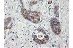 Image no. 4 for anti-Src-like-adaptor 2 (SLA2) antibody (ABIN1500948) (SLAP2 anticorps)