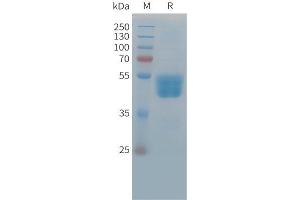 Cynomolgus TIGIT Protein, hFc Tag on SDS-PAGE under reducing condition.