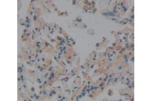 Used in DAB staining on fromalin fixed paraffin- embedded lung tissue (DICER1 anticorps  (AA 6-290))