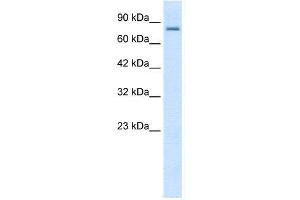 WB Suggested Anti-KCNN3  Antibody Titration: 0. (KCNN3 anticorps  (C-Term))