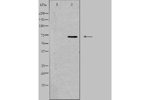 Western blot analysis of extracts from RAW264. (SCNN1D anticorps  (C-Term))
