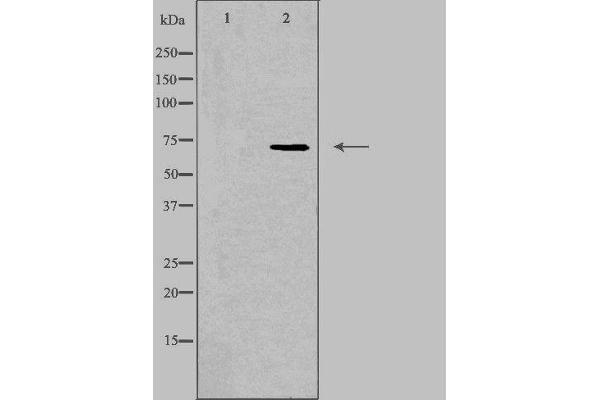 SCNN1D antibody  (C-Term)