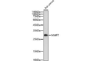 Western blot analysis of extracts of Rat uterus, using MMP7 antibody (ABIN3021102, ABIN3021103, ABIN3021104, ABIN1513214 and ABIN6213952) at 1:1000 dilution.