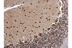 IHC-P Image BCL7A antibody [C2C3], C-term detects BCL7A protein at nucleus on rat hind brain by immunohistochemical analysis. (BCL7A anticorps  (C-Term))