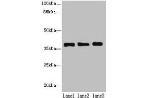 Western blot All lanes: MRPL44 antibody at 6 μg/mL Lane 1: Hela whole cell lysate Lane 2: Jurkat whole cell lysate Lane 3: K562 whole cell lysate Secondary Goat polyclonal to rabbit IgG at 1/10000 dilution Predicted band size: 38 kDa Observed band size: 38 kDa (MRPL44 anticorps  (AA 31-332))