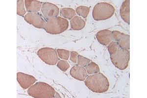 IHC-P analysis of Rat Tissue, with DAB staining. (TNNI1 anticorps  (AA 1-187))