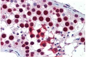 Human Testis: Formalin-Fixed, Paraffin-Embedded (FFPE)