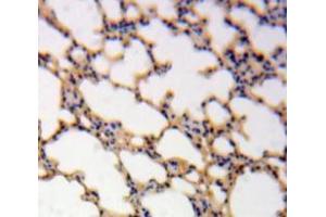 Used in DAB staining on fromalin fixed paraffin-embedded Lung tissue (IL-1 beta anticorps  (AA 117-269))