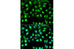 Immunofluorescence analysis of A549 cell using GEMIN2 antibody. (SIP1 anticorps)