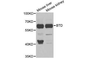 Western blot analysis of extracts of various cell lines, using BTD antibody.