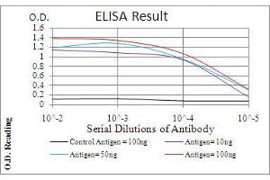 anti-Phospholipase C gamma 2 (PLCG2) (AA 826-985) antibody