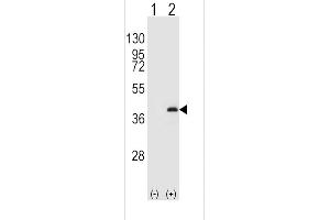 Western blot analysis of P1CB (arrow) using rabbit polyclonal P1CB Antibody  (ABIN392847 and ABIN2842269).