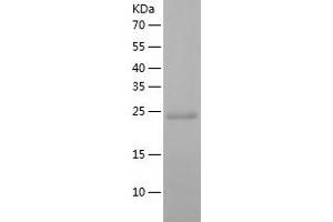 Western Blotting (WB) image for Dicarbonyl/L-Xylulose Reductase (DCXR) (AA 1-244) protein (His tag) (ABIN7122656)