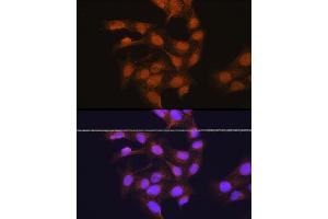 Immunofluorescence analysis of U-2 OS cells using 67 kDa Laminin Receptor Rabbit pAb (ABIN6128199, ABIN6147247, ABIN6147248 and ABIN6224857) at dilution of 1:100 (40x lens).