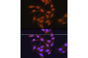 Immunofluorescence analysis of U-2 OS cells using 67 kDa Laminin Receptor Rabbit pAb (ABIN6128199, ABIN6147247, ABIN6147248 and ABIN6224857) at dilution of 1:100 (40x lens). (RPSA/Laminin Receptor anticorps  (AA 1-295))