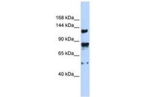 Image no. 1 for anti-Transient Receptor Potential Cation Channel, Subfamily M, Member 4 (TRPM4) (AA 359-408) antibody (ABIN6742557) (TRPM4 anticorps  (AA 359-408))