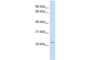 WB Suggested Anti-FGF11 Antibody Titration: 0. (FGF11 anticorps  (N-Term))