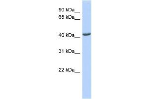 WB Suggested Anti-ST3GAL4 Antibody Titration:  0. (ST3GAL4 anticorps  (Middle Region))