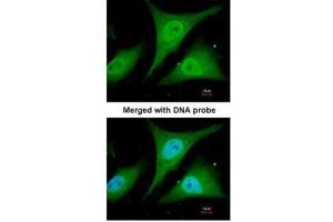 ICC/IF Image Immunofluorescence analysis of paraformaldehyde-fixed HeLa, using IkappaB-alpha, antibody at 1:200 dilution.