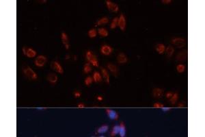 Immunofluorescence analysis of HeLa cells using GPC4 Polyclonal Antibody at dilution of 1:100. (GPC4 anticorps)