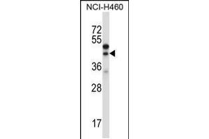 Western blot analysis in NCI-H460 cell line lysates (35ug/lane). (CTGF anticorps  (AA 166-193))