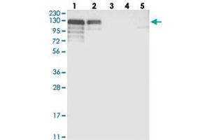 Western blot analysis of Lane 1: RT-4, Lane 2: U-251 MG, Lane 3: Human Plasma, Lane 4: Liver, Lane 5: Tonsil with NHSL1 polyclonal antibody  at 1:250-1:500 dilution.
