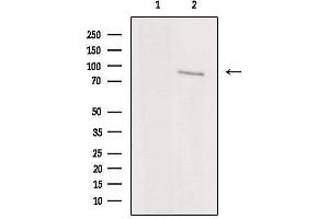 Western blot analysis of extracts from rat brain, using IKBKE Antibody.