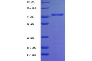 SDS-PAGE (SDS) image for Glycoprotein Ib (Platelet), alpha Polypeptide (GP1BA) (AA 17-505), (Extracellular) protein (His tag) (ABIN5709605)