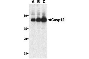 Western Blotting (WB) image for anti-Caspase 12 (Gene/pseudogene) (CASP12) (Large Isoform) antibody (ABIN1031699) (Caspase 12 anticorps  (Large Isoform))
