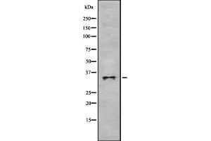 Western blot analysis OR52P1 using HeLa whole cell lysates (OR52P1 anticorps)