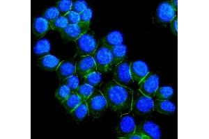 IF analysis of DSG2 using anti-DSG2 antibody (ABIN7600803). (Desmoglein 2 anticorps  (AA 24-1020))