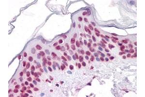 anti-Sirtuin 1 (SIRT1) (AA 456-555) antibody