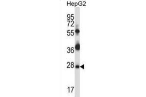 Western Blotting (WB) image for anti-TP53 Regulating Kinase (TP53RK) antibody (ABIN2997879) (TP53RK anticorps)