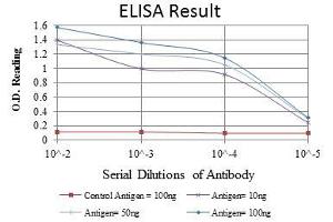 Red: Control Antigen (100 ng), Purple: Antigen (10 ng), Green: Antigen (50 ng), Blue: Antigen (100 ng), (Crk anticorps)