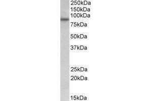 AP23219PU-N FSD1 antibody staining of HeLa lysate at 0. (RUFY1 anticorps  (Internal Region))