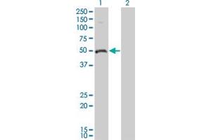 Western Blot analysis of ODC1 expression in transfected 293T cell line by ODC1 monoclonal antibody (M01), clone 2G5. (ODC1 anticorps  (AA 1-461))