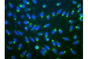 Immunofluorescent staining of aggresomes of mouse L-cells treated with lactacysteine, using RPS27A polyclonal antibody . (RPS27A anticorps)